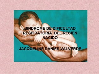 SINDROME DE DIFICULTAD 
RESPIRATORIA DEL RECIEN 
NACIDO 
JACQUELINE DANIES VALVERDE 
 