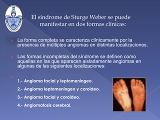 Síndrome de Sturge Weber Dimitiri