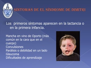   Enfermedad de Dimitri