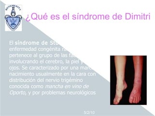¿Qué es el síndrome de Dimitri

El síndrome de Sturge-Weber es una
enfermedad congénita rara que
pertenece al grupo de las facomatosis
involucrando el cerebro, la piel y los
ojos. Se caracterizado por una marca de
nacimiento usualmente en la cara con
distribución del nervio trigémino
conocida como mancha en vino de
Oporto, y por problemas neurológicos


                              5/2/10
 
