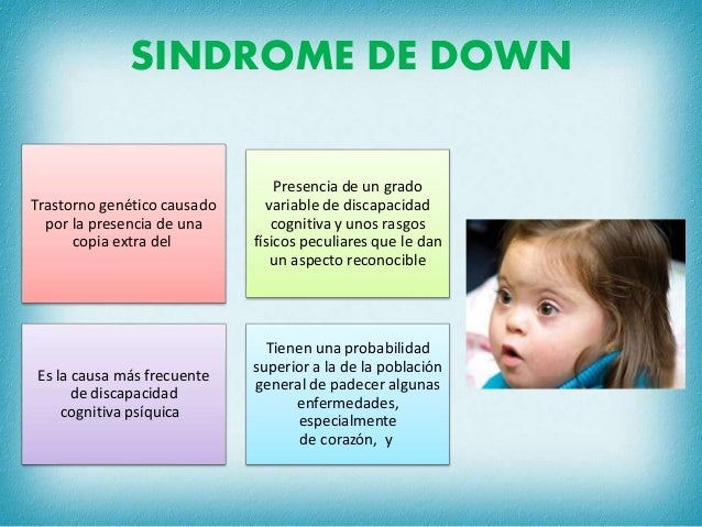 Síndrome de Down