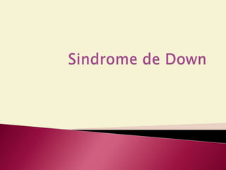 Sindrome de Down 