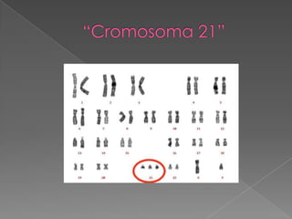 “Cromosoma 21”