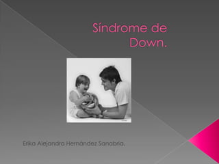 Síndrome de Down. Erika Alejandra Hernández Sanabria. 