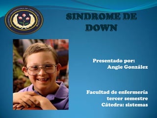 SINDROME DE DOWN Presentado por:  Angie González Facultad de enfermería  tercer semestre Cátedra: sistemas 