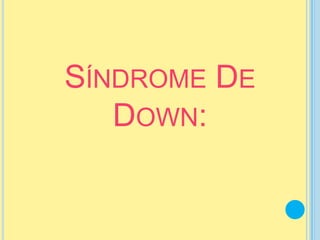 SÍNDROME DE
   DOWN:
 