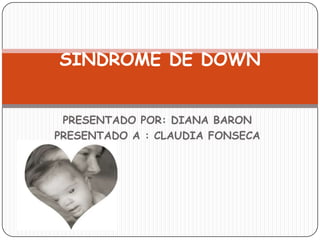 SINDROME DE DOWN


 PRESENTADO POR: DIANA BARON
PRESENTADO A : CLAUDIA FONSECA
 