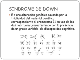 SINDROME DE DOWN
 E s una alteración genética causada por la
 triplicidad del material genético
 correspondiente al cromosoma 21 en vez de los
 dos habituales ,caracterizado por la presencia
 de un grado variable de discapacidad cognitiva.
 