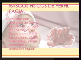  Los niños con
síndrome de Down
tienden a compartir
ciertos rasgos
físicos, como perfil
facial plano, ojos
achinados, orejas
pequeñas y
protrusión lingual.
 