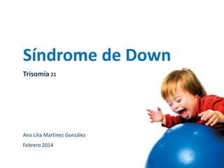 Síndrome de Down
Trisomía 21
Ana Lilia Martínez González
Febrero 2014
 