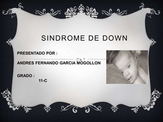 SINDROME DE DOWN 
PRESENTADO POR : 
ANDRES FERNANDO GARCIA MOGOLLON 
GRADO : 
11-C 
 