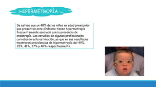 HIPERMETROPÍA 
Se estima que un 40% de los niños en edad preescolar 
que presentan este síndrome tienen hipermetropía 
fre...