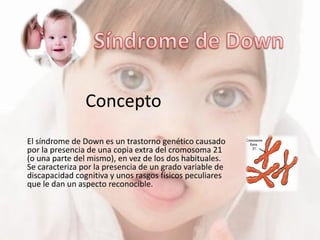 Concepto
El síndrome de Down es un trastorno genético causado
por la presencia de una copia extra del cromosoma 21
(o una parte del mismo), en vez de los dos habituales.
Se caracteriza por la presencia de un grado variable de
discapacidad cognitiva y unos rasgos físicos peculiares
que le dan un aspecto reconocible.
 