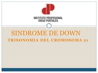 TRISONOMIA DEL CROMOSOMA 21
SINDROME DE DOWN
 