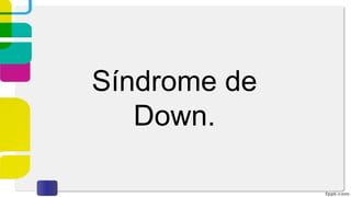 Síndrome de
Down.
 