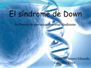 El síndrome de Down
 Nombre: Severo Eduardo
González Cruz
Inclusión de personas con este síndrome
 