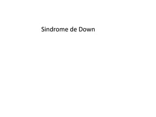 Sindrome de Down
 