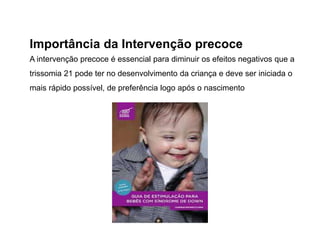 Importância da Intervenção precoce
A intervenção precoce é essencial para diminuir os efeitos negativos que a
trissomia 21 pode ter no desenvolvimento da criança e deve ser iniciada o
mais rápido possível, de preferência logo após o nascimento
 