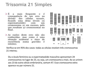 Verifica-se em 95% dos casos: todas as células revelam três cromossomas
21 inteiros;
Ou o óvulo feminino ou o espermatozóide masculino apresentam 24
cromossomos no lugar de 23, ou seja, um cromossomo a mais. Ao se unirem
aos 23 da outra célula embrionária, somam 47. Esse cromossomo extra
aparece no par número 21.
 