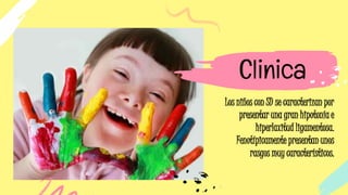 Los niños con SD se caracterizan por
presentar una gran hipotonía e
hiperlaxitud ligamentosa.
Fenotípicamente presentan unos
rasgos muy característicos.
Clinica
 