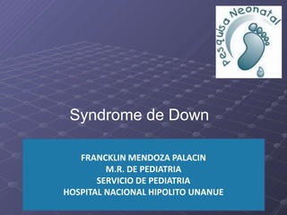 FRANCKLIN MENDOZA PALACIN
M.R. DE PEDIATRIA
SERVICIO DE PEDIATRIA
HOSPITAL NACIONAL HIPOLITO UNANUE
Syndrome de Down
 