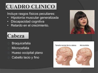 SINDROME DE DOWN.pptx
