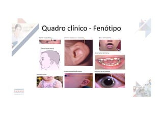 Quadro clínico - Fenótipo
 