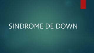 SINDROME DE DOWN
 