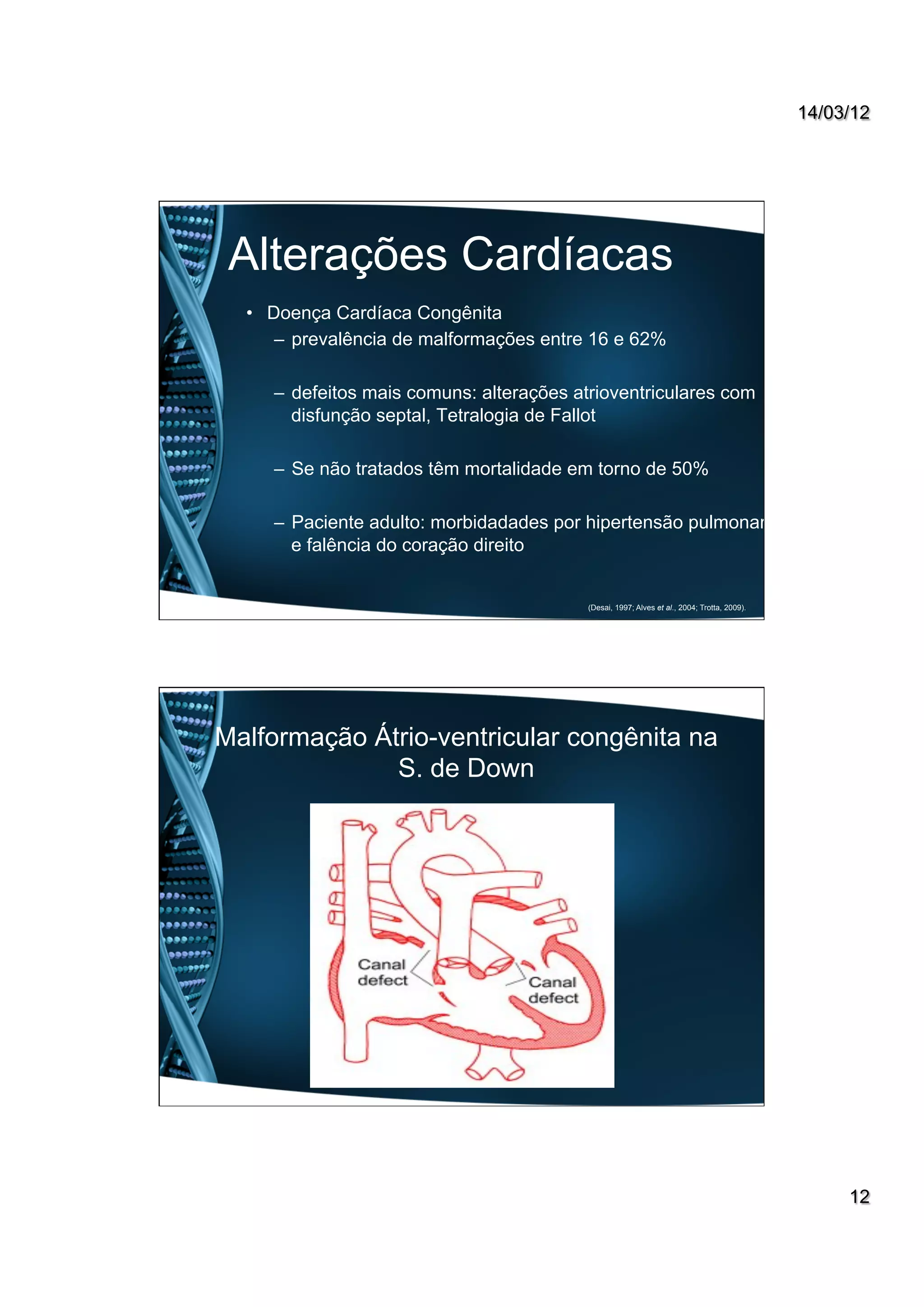 14/03/12
12
Alterações Cardíacas
•  Doença Cardíaca Congênita
–  prevalência de malformações entre 16 e 62%
–  defeitos mais comuns: alterações atrioventriculares com
disfunção septal, Tetralogia de Fallot
–  Se não tratados têm mortalidade em torno de 50%
–  Paciente adulto: morbidadades por hipertensão pulmonar
e falência do coração direito
(Desai, 1997; Alves et al., 2004; Trotta, 2009).
Malformação Átrio-ventricular congênita na
S. de Down
 