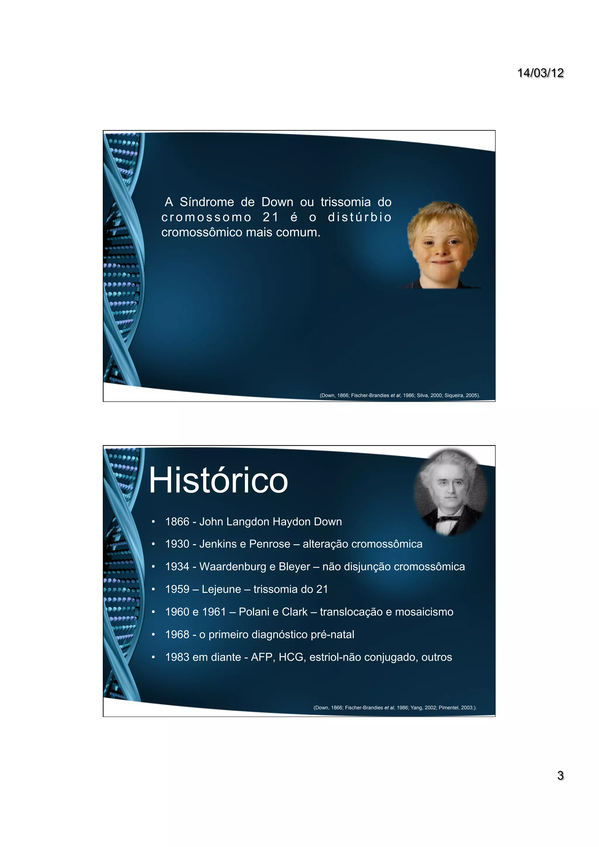 14/03/12
3
A Síndrome de Down ou trissomia do
c r o m o s s o m o 2 1 é o d i s t ú r b i o
cromossômico mais comum.
(Down, 1866; Fischer-Brandies et al, 1986; Silva, 2000; Siqueira, 2005).
Histórico
•  1866 - John Langdon Haydon Down
•  1930 - Jenkins e Penrose – alteração cromossômica
•  1934 - Waardenburg e Bleyer – não disjunção cromossômica
•  1959 – Lejeune – trissomia do 21
•  1960 e 1961 – Polani e Clark – translocação e mosaicismo
•  1968 - o primeiro diagnóstico pré-natal
•  1983 em diante - AFP, HCG, estriol-não conjugado, outros
(Down, 1866; Fischer-Brandies et al, 1986; Yang, 2002; Pimentel, 2003;).
 