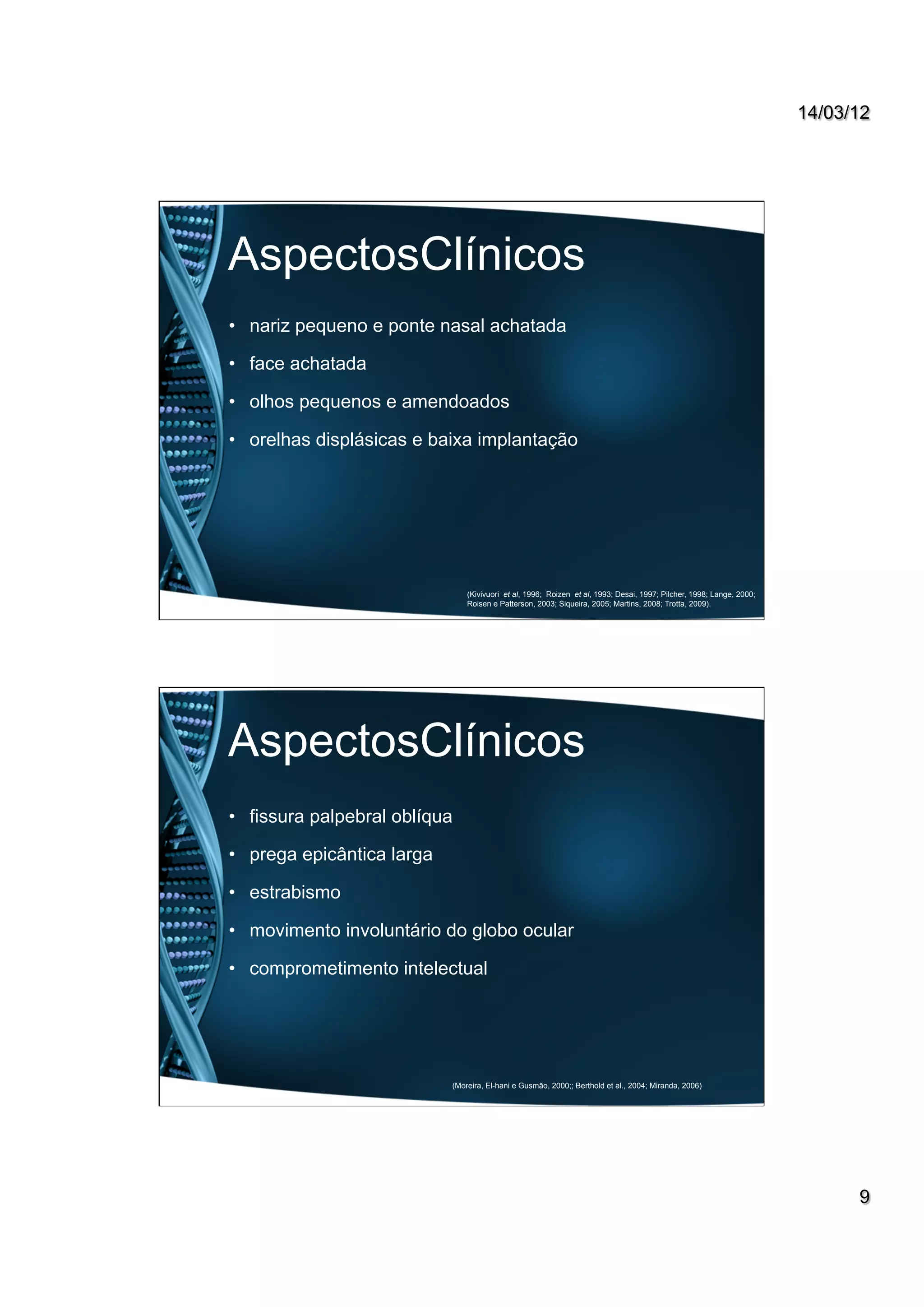 14/03/12
9
AspectosClínicos
•  nariz pequeno e ponte nasal achatada
•  face achatada
•  olhos pequenos e amendoados
•  orelhas displásicas e baixa implantação
(Kivivuori et al, 1996; Roizen et al, 1993; Desai, 1997; Pilcher, 1998; Lange, 2000;
Roisen e Patterson, 2003; Siqueira, 2005; Martins, 2008; Trotta, 2009).
AspectosClínicos
•  fissura palpebral oblíqua
•  prega epicântica larga
•  estrabismo
•  movimento involuntário do globo ocular
•  comprometimento intelectual
(Moreira, El-hani e Gusmão, 2000;; Berthold et al., 2004; Miranda, 2006)
 