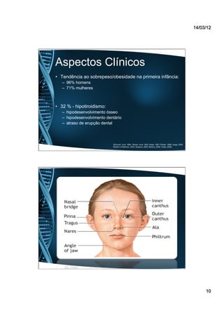 14/03/12
10
Aspectos Clínicos
•  Tendência ao sobrepeso/obesidade na primeira infância:
–  96% homens
–  71% mulheres
•  32 % - hipotiroidismo:
–  hipodesenvolvimento ósseo
–  hipodesenvolvimento dentário
–  atraso de erupção dental
(Kivivuori et al, 1996; Roizen et al, 1993; Desai, 1997; Pilcher, 1998; Lange, 2000;
Roisen e Patterson, 2003; Siqueira, 2005; Martins, 2008; Trotta, 2009).
 