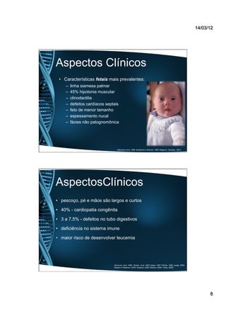 14/03/12
8
Aspectos Clínicos
•  Características fetais mais prevalentes:
–  linha siamesa palmar
–  45% hipotonia muscular
–  clinodactilia
–  defeitos cardíacos septais
–  feto de menor tamanho
–  espessamento nucal
–  fácies não patognomônica
(Marciano et al, 1986; Mustacchi e Rozone, 1990; Regezi e Sciubba, 1991)
AspectosClínicos
•  pescoço, pé e mãos são largos e curtos
•  40% - cardiopatia congênita
•  3 a 7,5% - defeitos no tubo digestivos
•  deficiência no sistema imune
•  maior risco de desenvolver leucemia
(Kivivuori et al, 1996; Roizen et al, 1993; Desai, 1997; Pilcher, 1998; Lange, 2000;
Roisen e Patterson, 2003; Siqueira, 2005; Martins, 2008; Trotta, 2009).
 