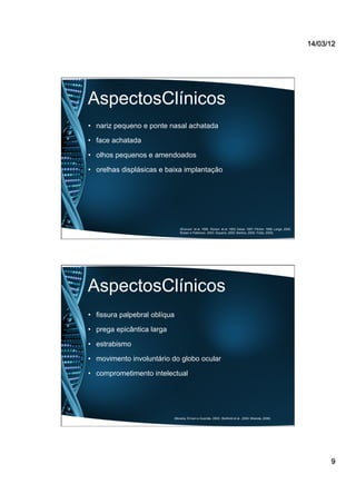 14/03/12
9
AspectosClínicos
•  nariz pequeno e ponte nasal achatada
•  face achatada
•  olhos pequenos e amendoados
•  orelhas displásicas e baixa implantação
(Kivivuori et al, 1996; Roizen et al, 1993; Desai, 1997; Pilcher, 1998; Lange, 2000;
Roisen e Patterson, 2003; Siqueira, 2005; Martins, 2008; Trotta, 2009).
AspectosClínicos
•  fissura palpebral oblíqua
•  prega epicântica larga
•  estrabismo
•  movimento involuntário do globo ocular
•  comprometimento intelectual
(Moreira, El-hani e Gusmão, 2000;; Berthold et al., 2004; Miranda, 2006)
 
