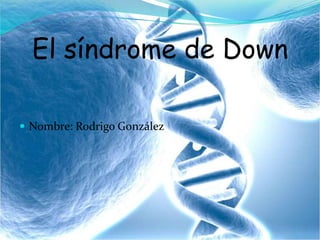 El síndrome de Down
 Nombre: Rodrigo González
 