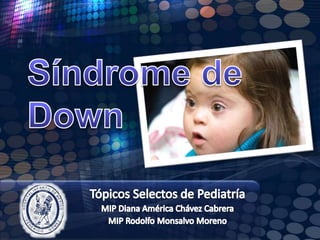 Síndrome de Down  Tópicos Selectos de Pediatría MIP Diana América Chávez Cabrera MIP Rodolfo Monsalvo Moreno 