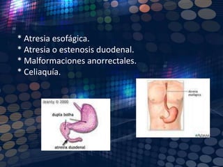 Conducto arterioso persistente