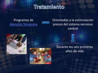 DiagnósticoRealizar mediciones por ecografía (longitud del fémur, grosor del pliegue nucal).Amniocentesis de la 14-17 semana.Biopsia de vellosidades corionicas de la  8-11 SDG