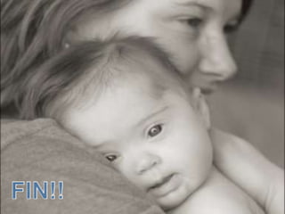 La evaluación clínica del corazón para descartar problemas de la válvula mitral/aórtica.Problemas de la pubertad / sexualidad, la educación sanitaria, prevención del abuso y la sexualidad. Examen pélvico (sólo si es sexualmente activa).Alimentación: Bajas en calorías, dieta alta en fibra, ejercicio regularEducación fumadores, drogas y alcohol.Supervisar grado de independencia.DOWN SYNDROME HEALTH CARE GUIDELINES (Based on 1999 Down Syndrome Health Care Guidelines)* Adolescence (12-18 Years)