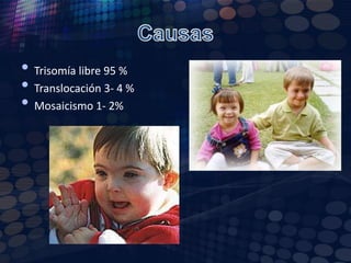 CausasTrisomía libre 95 %Translocación 3- 4 %Mosaicismo 1- 2%