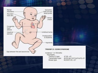 Cuadro clínicoOcurren entre un 40 y un 50% de los recién nacidos. Es la causa principal de mortalidad en niños con SDLas mas frecuentes son:Defectos del septo-auriculo-ventricular. Defectos de cierre del septo-ventricular. Tetralogía de fallot. 