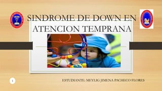 SINDROME DE DOWN EN
ATENCION TEMPRANA
ESTUDIANTE: MEYLIG JIMENA PACHECO FLORES1
 