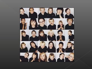 Sindrome de down_ou_trissomia_de_cromossoma_21