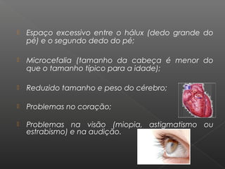  Espaço excessivo entre o hálux (dedo grande do
pé) e o segundo dedo do pé;
 Microcefalia (tamanho da cabeça é menor do
que o tamanho típico para a idade);
 Reduzido tamanho e peso do cérebro;
 Problemas no coração;
 Problemas na visão (miopia, astigmatismo ou
estrabismo) e na audição.
 