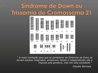 “ A maior limitação para que os portadores de Síndrome de Down se
tornem adultos integrados, produtivos, felizes e independentes não é
imposta pela genética, mas sim pela sociedade.”
-Claudia Werneck
 