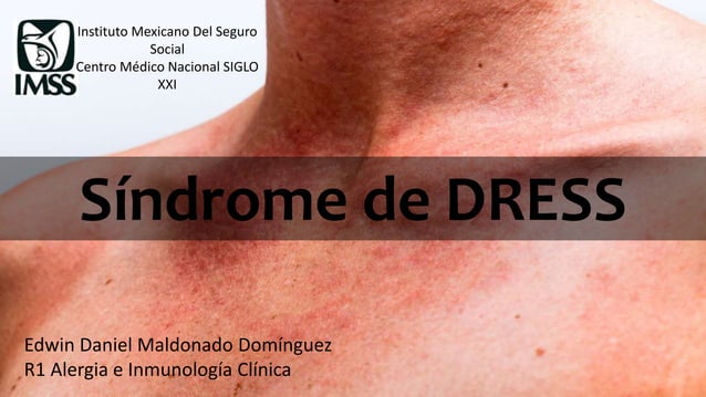 Síndrome de DRESS PPT