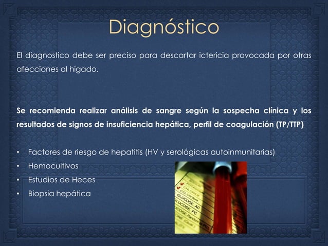 Sindrome de dubin johnson PPT