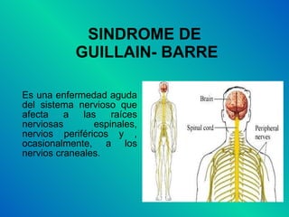 SINDROME DE  GUILLAIN- BARRE Es una enfermedad aguda del sistema nervioso que afecta a las raíces nerviosas espinales, nervios periféricos y , ocasionalmente, a los nervios craneales. 