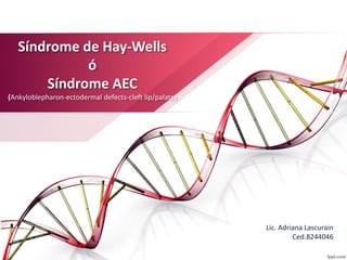 Síndrome de Hay-Wells
ó
Síndrome AEC
(Ankyloblepharon-ectodermal defects-cleft lip/palate)
Lic. Adriana Lascurain
Ced.8244046
 