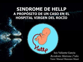 SINDROME DE HELLP

A PROPÓSITO DE UN CASO EN EL
HOSPITAL VIRGEN DEL ROCÍO

Isis Valiente García
Residente Matrona 2ºaño
Tutor: Manuel Manzano Mauri

 